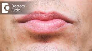 what causes discoloration below lip