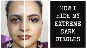 how to hide dark circles step by