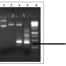 Double Digested Plasmids Lanes 1 And 6 1 Kb Dna Ladder