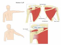 Dealing with the wear and tear tendon injury and the process of inflammation that comes with it is the best option in that case. How To Self Diagnose Your Shoulder Pain Breaking Muscle