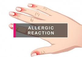 an allergic reaction to gel nail polish