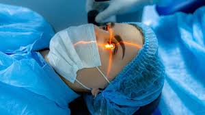 ilasik laser eye surgery