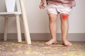 is your child experiencing leg pain