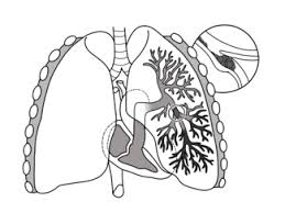Plicní embolii nelze diagnostikovat ani vyloučit pouze na základě ekg, protože se jedná pouze o nespecifické změny.pozitivní nález na ekg diagnózu silně podporuje. Pulmonary Embolism Wikipedia