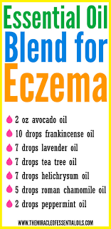 diy essential oil blend for eczema