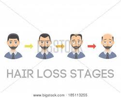 Information Chart Vector Photo Free Trial Bigstock