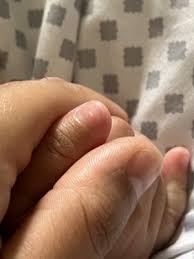 white spot in thumb nail babycenter