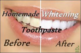 10 effective ways to naturally whiten your teeth without destroying your enamel. Whiten Your Teeth Naturally With This Homemade Whitening Toothpaste Recipe Healthy Food House
