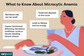 microcytic anemia causes symptoms
