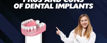 pros cons of all on 4 dental implants