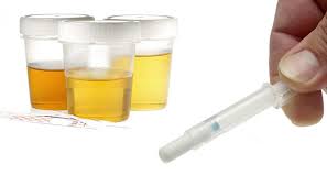 Urine drug testing 'fake pee' on the rise
