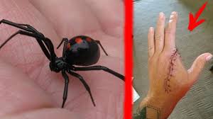 Черная вдова принадлежит к тому типу пауков, чей яд для человека является смертоносным. Chto Budet Esli Ukusit Chernaya Vdova Ukus Chernoj Vdovy Youtube