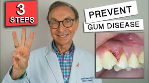 3 easy ways to prevent gum disease at