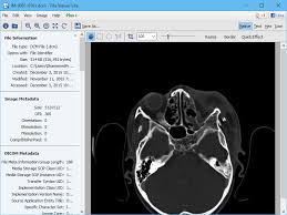 Open dicom viewer is a small display of medical images. Open Nema Dcm And Dicom Files