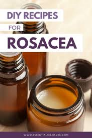 5 best essential oils for rosacea plus
