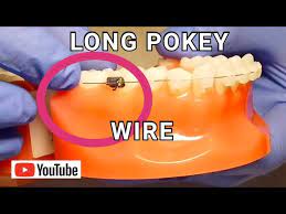 broken braces long poking wire