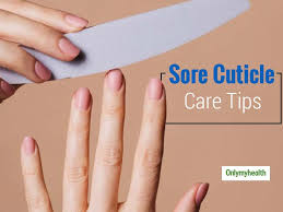home remes for sore cuticles