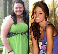 Resultado de imagen de fotos de personas obesas antes y despues