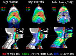 intensity modulated proton therapy