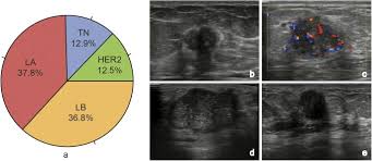 Hypoechoic means looks darker on ultrasound of the surrounding tissues. Identifying Ultrasound And Clinical Features Of Breast Cancer Molecular Subtypes By Ensemble Decision Scientific Reports