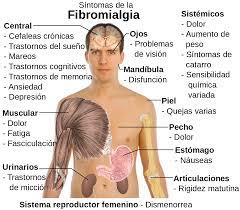 Fibromyalgia causes widespread muscle and joint pain as well as fatigue. File Sintomas De La Fibromialgia Es Svg Wikimedia Commons
