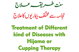 Hijama Cupping Therapy Kiya hai aur is k Faiyday? Roman Urdu main Parhain