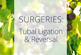 tubal ligation reversal