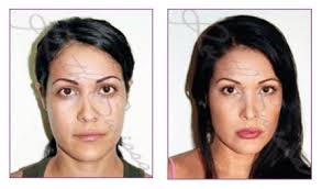 permanent makeup correction in los