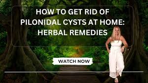 how to get rid of pilonidal cysts at