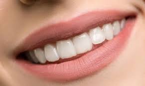 natural teeth whitening home remes