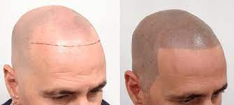 scalp pigmentation why organic