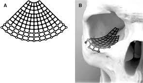 exle of anium mesh a that can