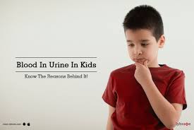 blood in urine in kids know the