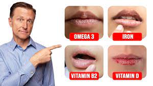 discolored or dry lips can indicate