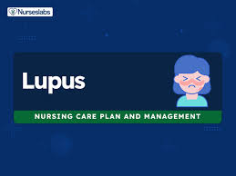 7 systemic lupus erythematosus nursing