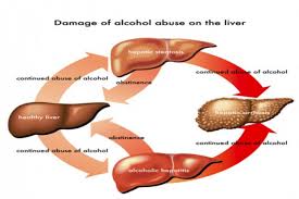 Scientists find way to prevent alcohol damage to liver - ANTARA News