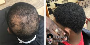 7,856 likes · 303 talking about this. Men S Hair Replacement Services In Houston Tx Joe Black Barbershop