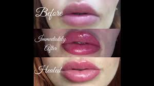 semi permanent lip tattoo healing