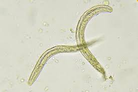 pinworms symptoms causes diagnosis