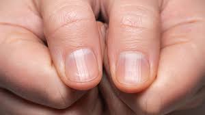 what those ridges on your fingernails