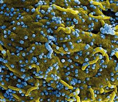 Éxito en experimentos con un fármaco para combatir a un coronavirus |  Noticias de la Ciencia y la Tecnología (Amazings® / NCYT®)