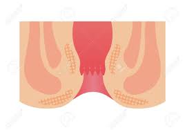 Cross Section Of Rectum And Anus / Vector Illustration Royalty Free SVG,  Cliparts, Vectors, And Stock Illustration. Image 146581566.