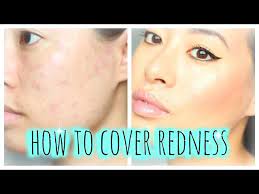 how to cover redness allergic