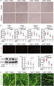 connexin43 promotes angiogenesis