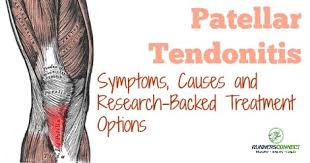 patellar tendonitis in runners