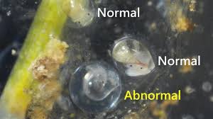 I am not having any luck with googling. Wild Pond Snail Eggs Abnormal Vs Normal Development Hatching Youtube