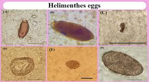 Protozoan And Helminthes Parasites Endorsed By Imported