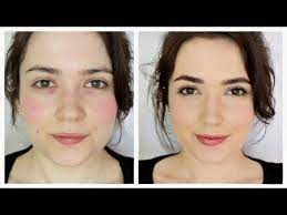 how to cover rosacea redness you