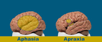 aphasia and apraxia