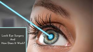 lasik eye surgery and how does it work
